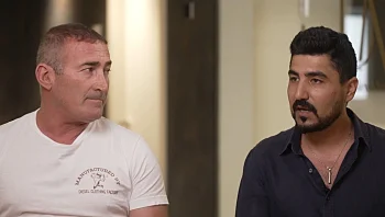 השגת חיוך שרצינו גם בהעדר עצם תחתונה