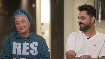 ציפויי שיניים במראה טבעי