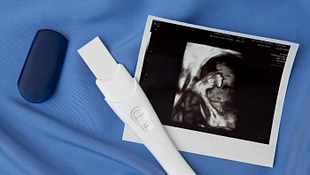 מה חשוב לבדוק בשליש הראשון בהריון – ואיך לא לפספס מידע חשוב?