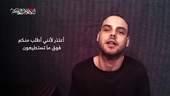 משפחת אהל התירה לפרסום תמונה מהתיעוד: "אלון התעוור בעין אחת"