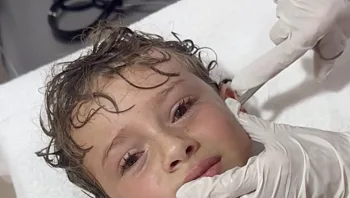 ילד בן 8 סבל מכאבים לאחר בילוי בים – וזה מה שמצאו לו באוזן