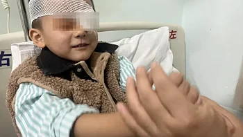 בן 5 התעוור בעין אחת לאחר שהגננת מרחה עליה שומן חזיר