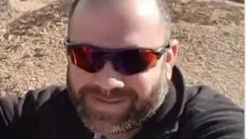 ויטל מישייב הצית עצמו ונפגע באורח קשה: "הכתובת הייתה על הקיר"