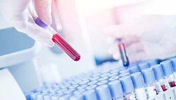 התקלה בבדיקה לגילוי סרטן השד: בדיקה חוזרת לכ-2,000 נשים