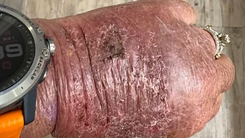 רצתה לשמור על איכות הסביבה - וזה מה שקרה ליד שלה