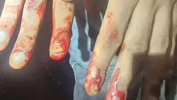 דקר, ברח ונתפס: תיעוד המרדף אחר הצעיר שנמלט מהשוטרים