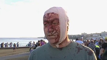 "ראיתי דבר כזה רק ב-7.10": שרד את הטבח - ונפצע בפיגוע בסידני