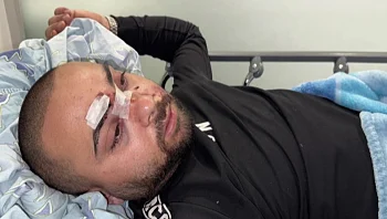 צעירים ערבים הותקפו על רקע גזעני בתל אביב: "אין צדק במדינה"