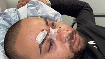 "בגלל שאני ערבי": מחמוד הותקף בת"א, החשודים שוחררו