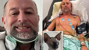 "זה קרה בבת אחת": הגבר שנתקל בחתול שלו - ושבר את הגולגולת