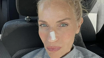 המגישה והעיתונאית חושפת: "גילו לי סרטן"