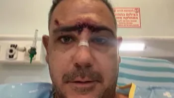 הישראלי שנפצע עם כלביו מפגיעת טיל באילת משחזר: "סרט אימה"