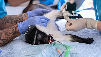 רגע לפני קטיעה - ואז לידה: הניתוח המורכב שהציל מין שלם 