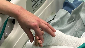 בן 4 נכווה לאחר שנפל לסיר מרק בבית כנסת בירושלים, מצבו יציב