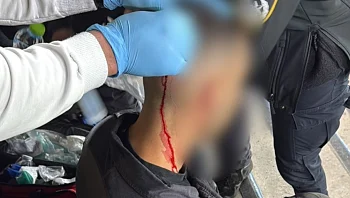 מכבי חיפה נגד המשטרה: "עשרות אוהדים חזרו פצועים הביתה"