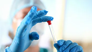 מדען הרעיל קולגה לעבודה - רק בשביל לקבל במקומו קידום