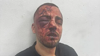 פרקליט בב"ש הותקף במעצר אלים: "שוטרים הכו אותו באגרופים"