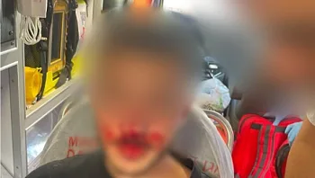 אלימות לפני הדרבי: צעיר הותקף סמוך לבלומפילד, 3 נעצרו