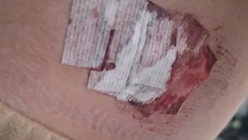 ילד בן 12 נדקר בגן שעשועים: "חייבים לעצור את התופעה"