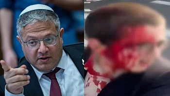 האלימות המשטרתית בהפגנות - והתשובה השערורייתית של בן גביר