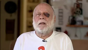 בן 79 הותקף באלימות בירושלים: "בעט בי כשאני על הרצפה"