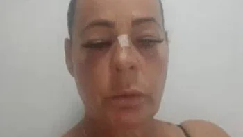 הותקפה בבריכה כי העירה לגבר שצילם קטינות: "כבר לא מסתובבת לבד"