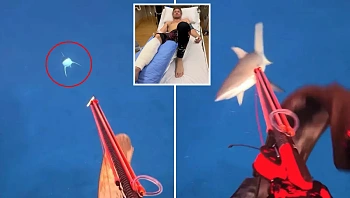 שרד תקיפת כריש שכמעט קטעה את רגלו - ואז שיתף מסר מפתיע
