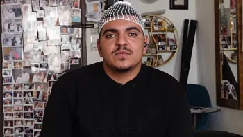 האוהד שהותקף במוט ברזל: "אם לא הייתי מתכופף, הייתי נפגע הרבה יותר חמור"
