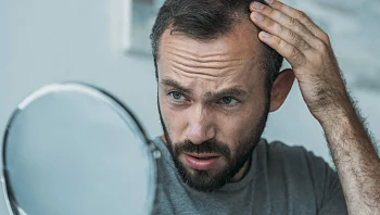 סובלים מהתקרחות? מהתרופה הנפוצה הזו אולי תגיע הישועה