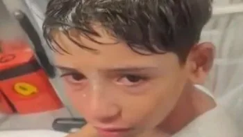 אחרי שסגרה את התיק: המשטרה חוקרת את תקיפת הילד הנוצרי בי-ם