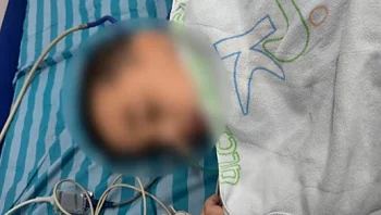 בן 4 על הרצף בלע 37 מגנטים בגן: "הילד התפתל מכאבים"