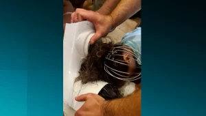 שיערה של בת 6 נתקע במיקסר חשמלי - וכמעט תלש לה את הקרקפת