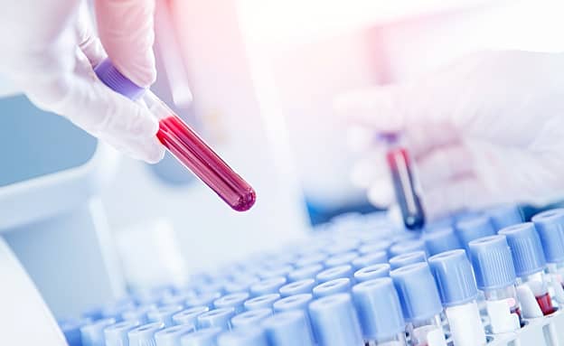 התקלה בבדיקה לגילוי סרטן השד: בדיקה חוזרת לכ-2,000 נשים | חדשות 13