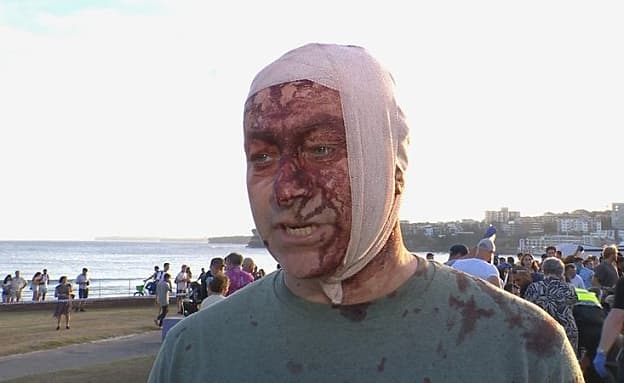 „ראיתי דבר כזה רק ב-7.10”: שרד את הטבח – ונפצע בפיגוע בסידני | חדשות 13