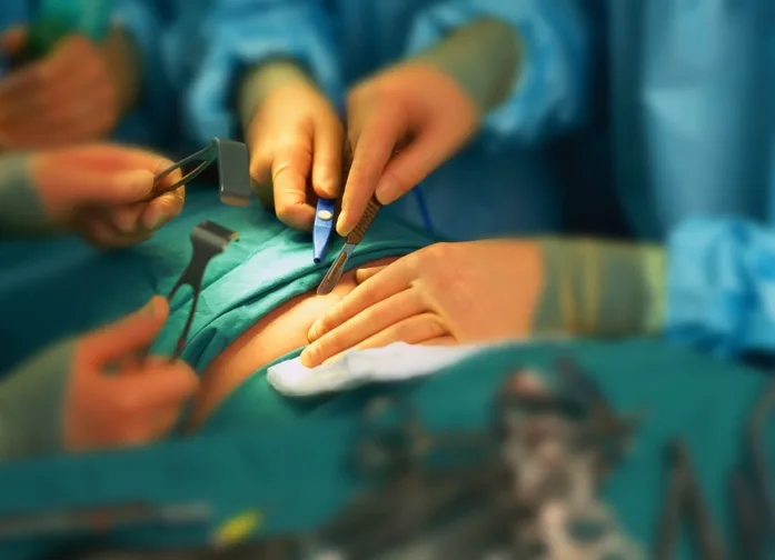 חדר ניתוחים