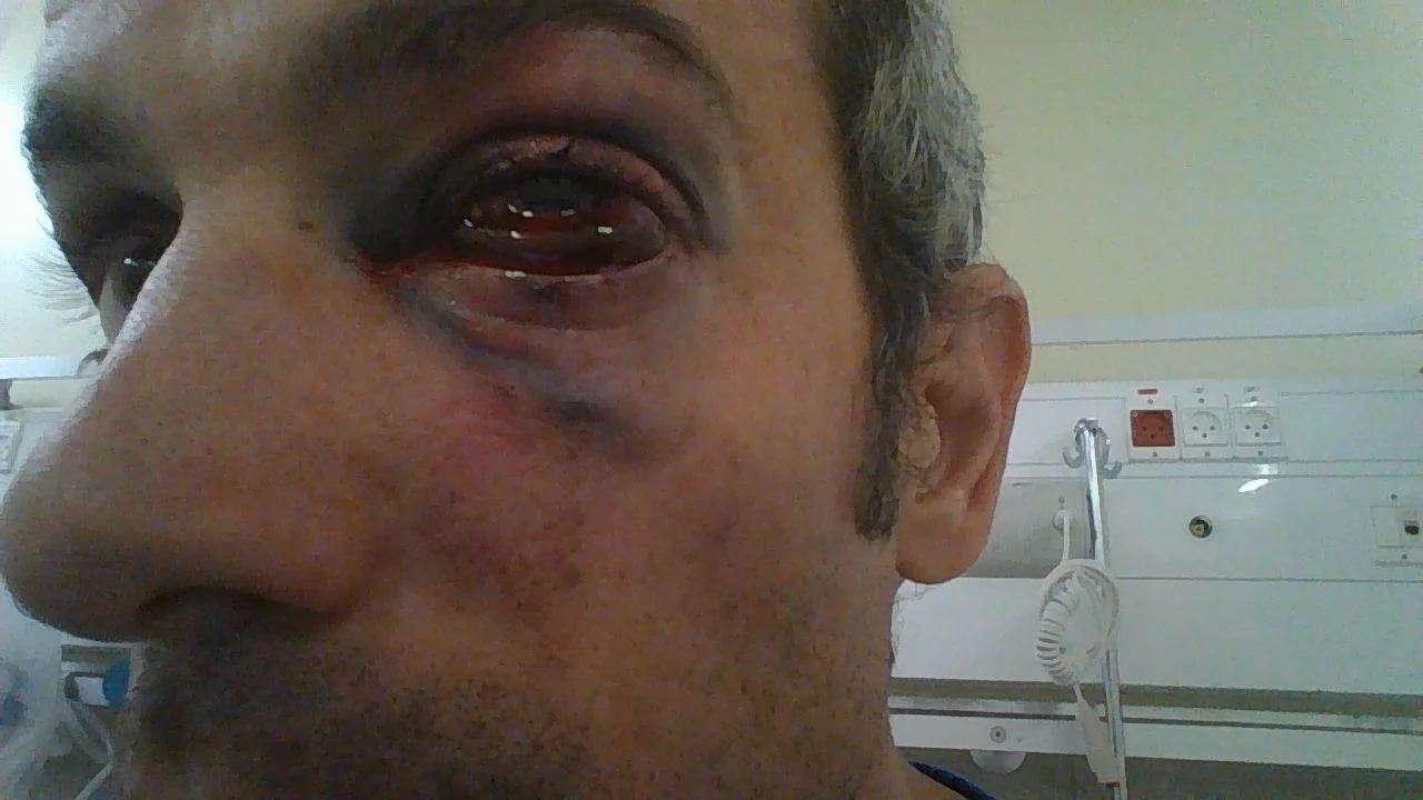 ניר פנקס שהותקף לטענתו על ידי אורחי צימר בצפון