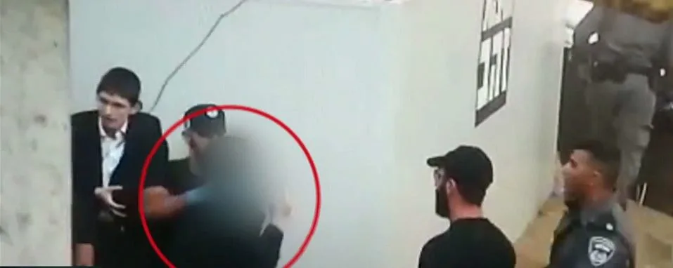 אלימות משטרתית והפיצוי: חרדי שהותקף ע''י שוטר יקבל 17 אלף שקל