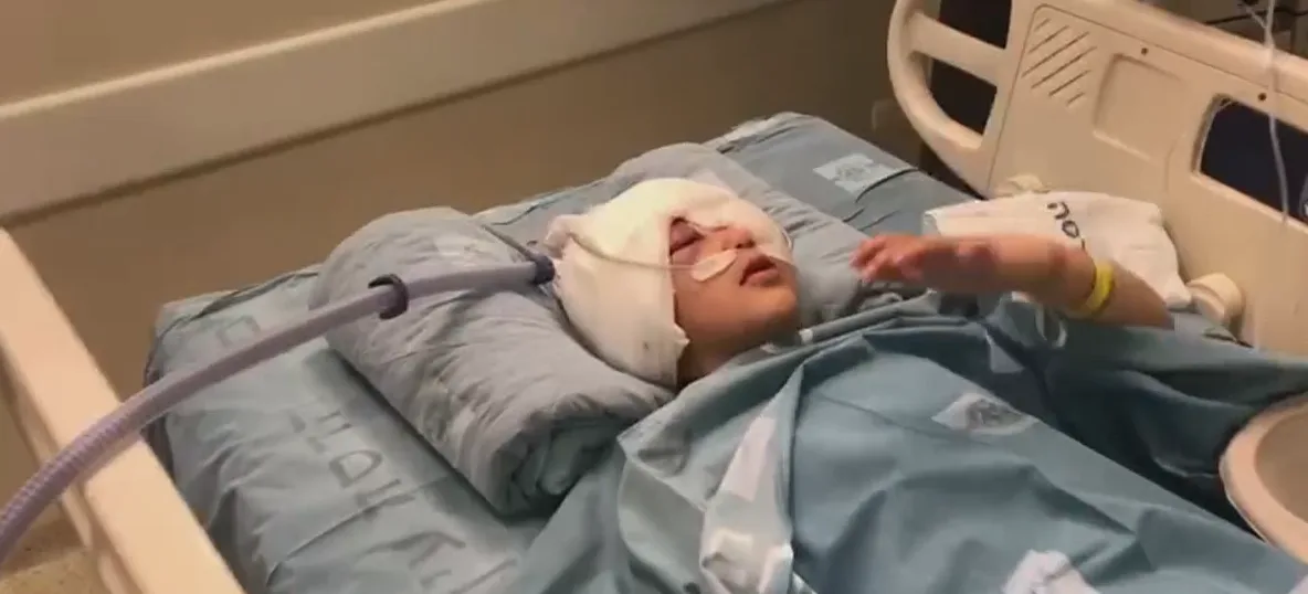 מאליכ עיסא, נפגע מירי קליע ספוג