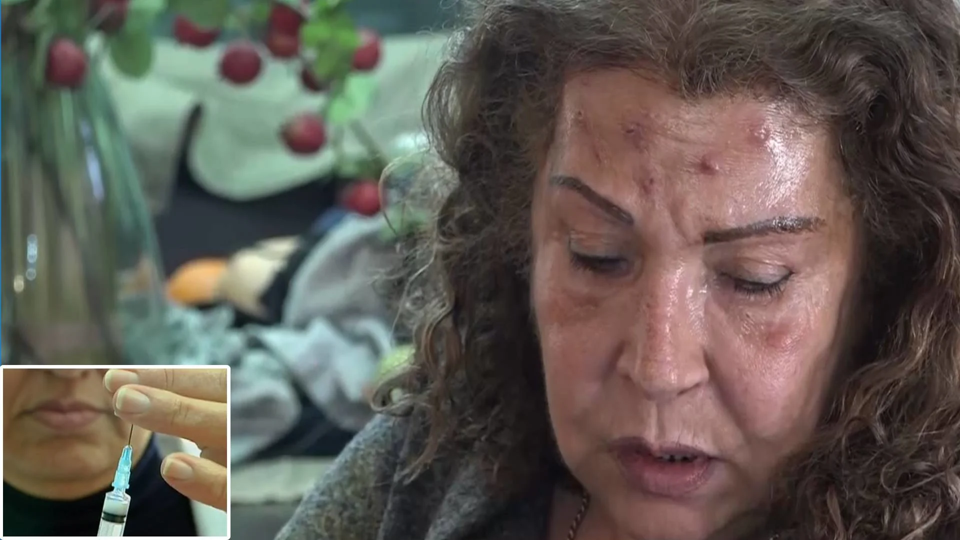 שני פדלון, שנפגעה מטיפולי בוטוקס בידי קוסמטיקאית שאינה מורשית לכך