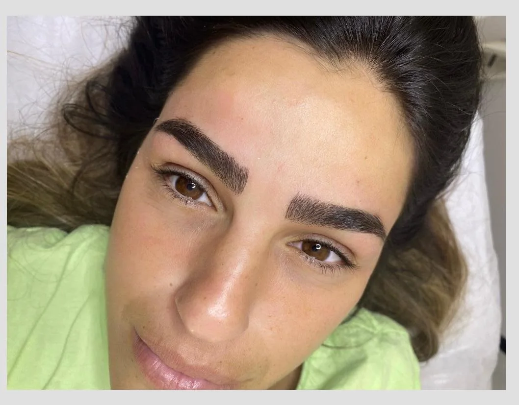 מיקרובליידינג ע''י מרין בוגנים