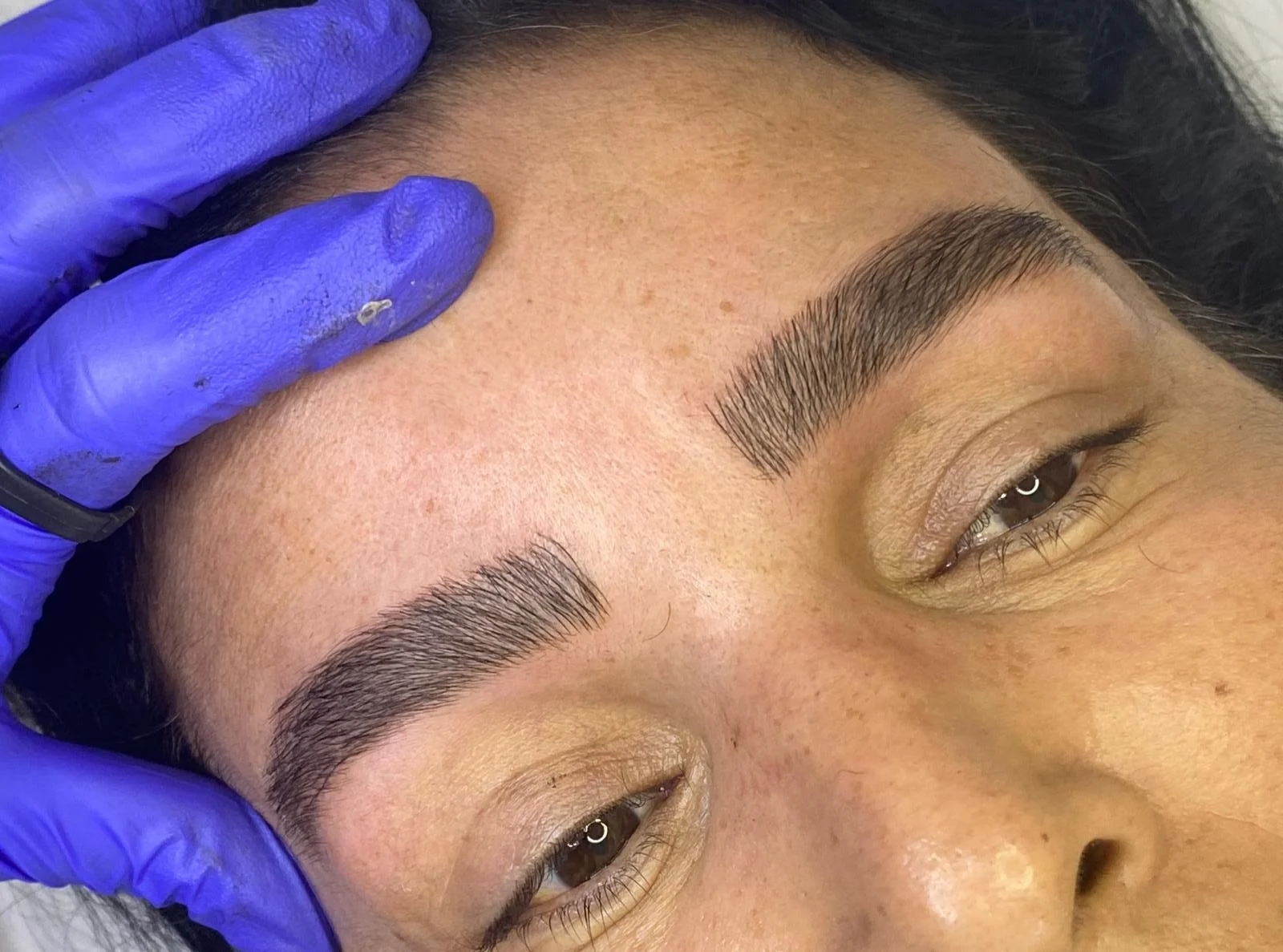 מיקרובליידינג ע''י מרין בוגנים