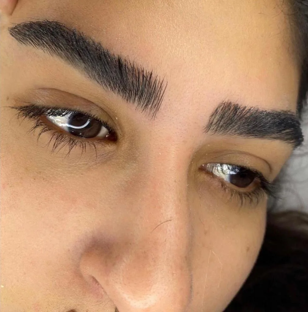 מיקרובליידינג ע''י מרין בוגנים