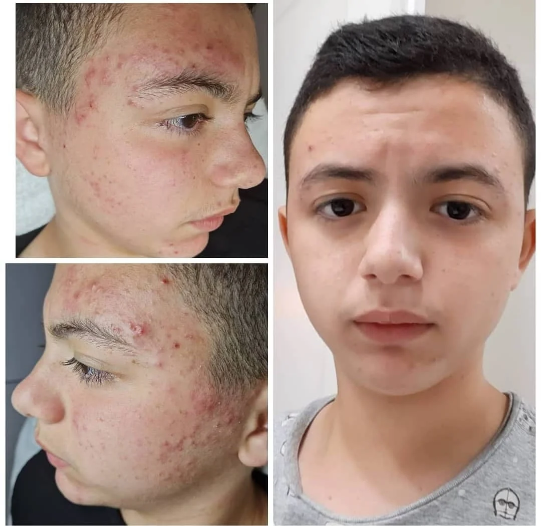 טיפולי פנים אצל שרי לוי שרי קוסמטיקס