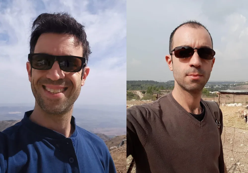 תמונות ''לפני ואחרי'' של ליאור ספיר, לקוח מרוצה של דיזנהאוז-מדיקל.