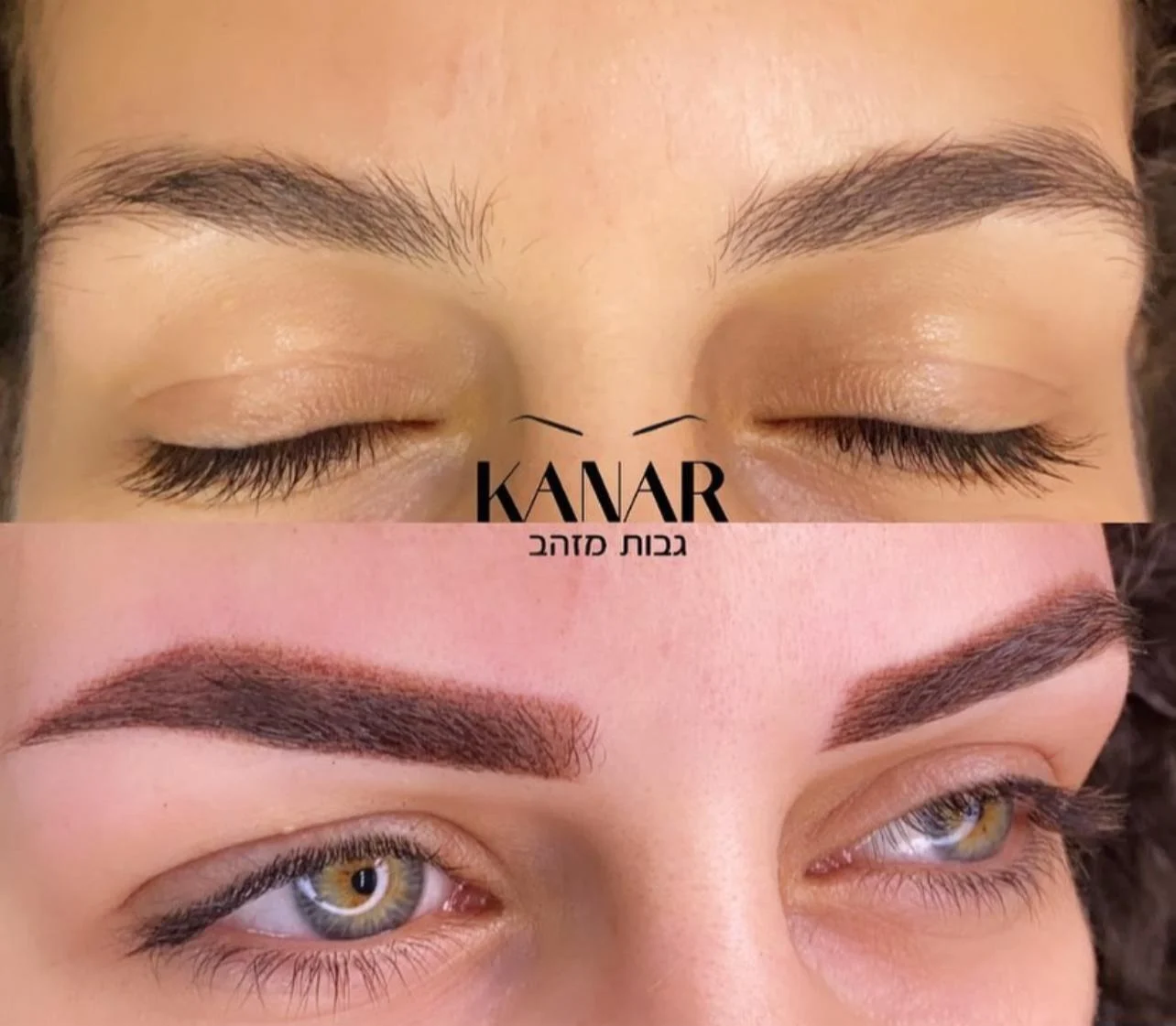 טיפול גבות אצל קאנר