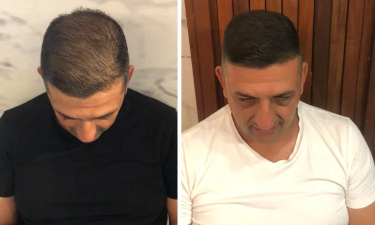 מיקרו מינרל