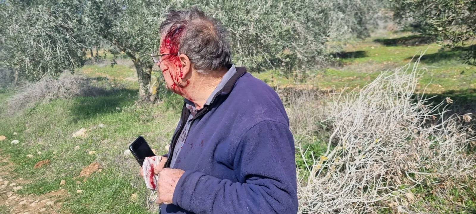 אחד הפעילים שהותקף על ידי המתנחלים