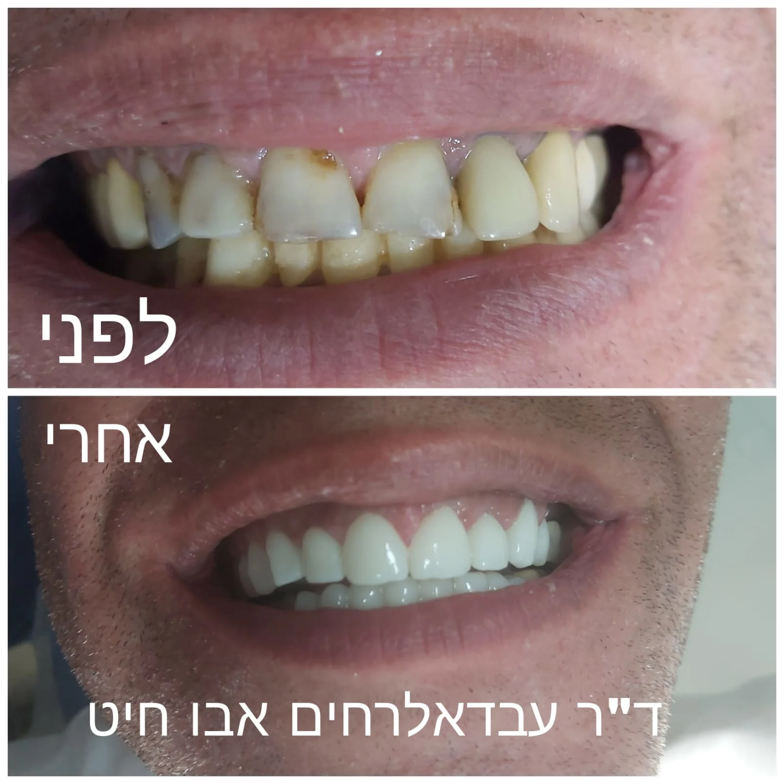 שיניים