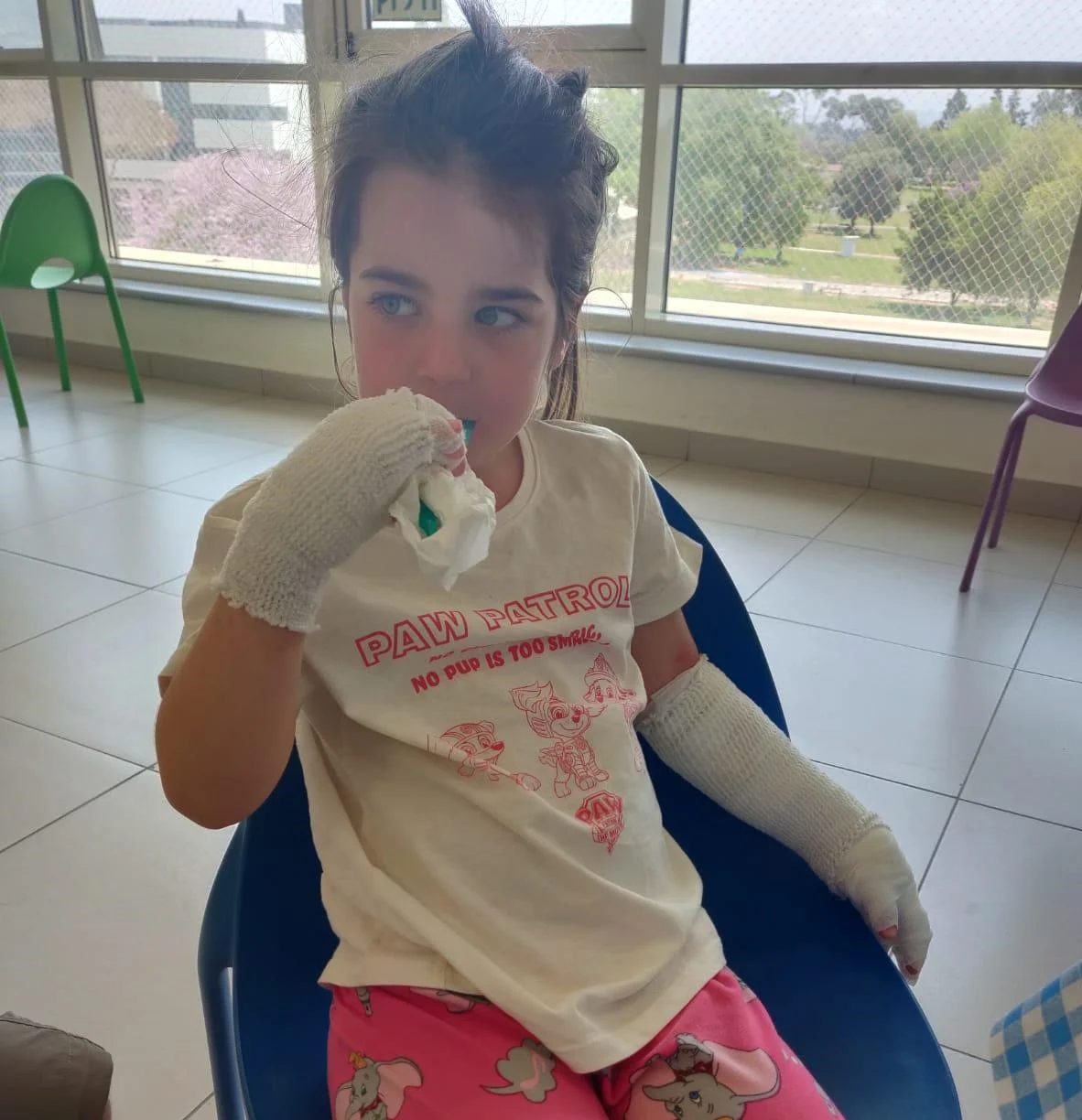 נאלצה לקבל טיפול רפואי בעקבות מגע עם עץ תאנה