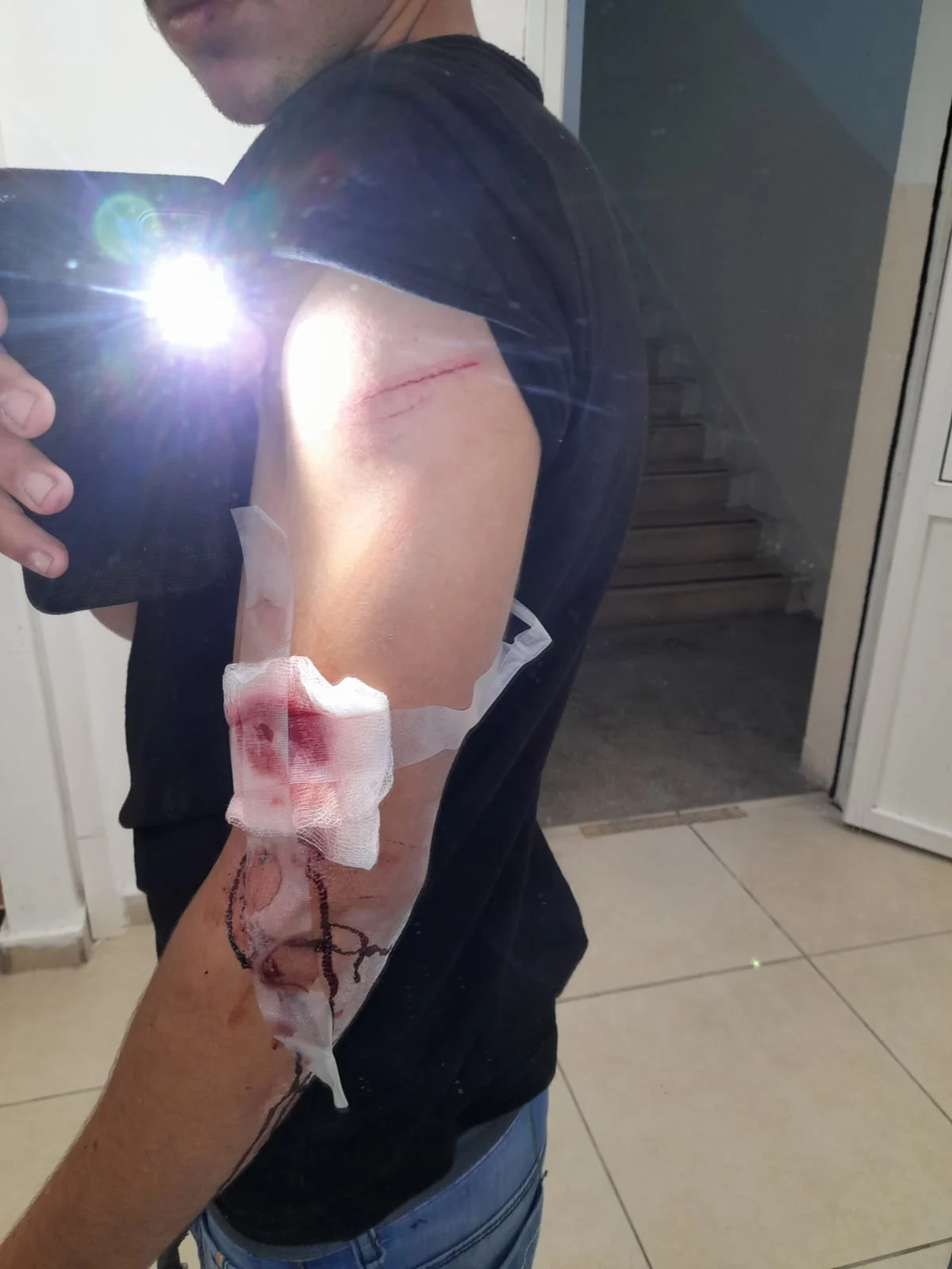 פציעות נער תקיפה עכו עיר עתיקה מקלות סכין